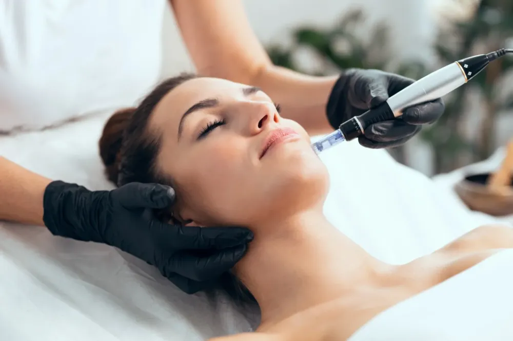 Microneedling à Hœrdt